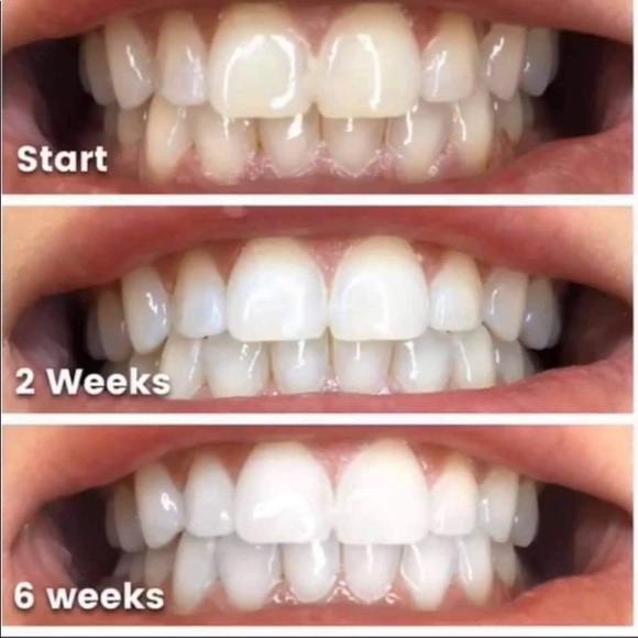 New-Three (3)Nuskin Ap24 Whitening Fluoride Toothpaste - Picture 12 of 17